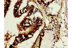 Immunohistochemistry (IHC) image for anti-TROVE Domain Family, Member 2 (TROVE2) (AA 3-535) antibody (ABIN7142715)