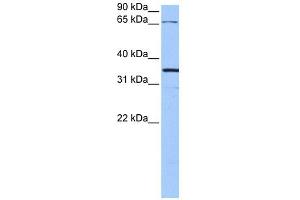 NLGN4X antibody used at 1 ug/ml to detect target protein. (Neuroligin 4 抗体  (N-Term))