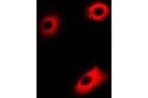Immunofluorescent analysis of DLD staining in U2OS cells. (DLD 抗体)