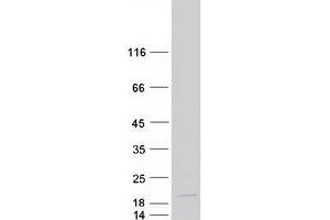 Western Blotting (WB) image for Small Nuclear Ribonucleoprotein 25kDa (U11/U12) (SNRNP25) protein (Myc-DYKDDDDK Tag) (ABIN2732321)