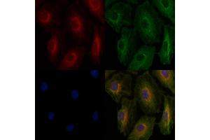 ABIN6262382 and ABIN6276902 staining  cells by IF/ICC. (HSD3B2 抗体)
