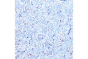 Immunohistochemistry of paraffin-embedded mouse liver using Na+/K+-ATPase Rabbit mAb (ABIN7270390) at dilution of 1:100 (40x lens). (ATP1A1 抗体)