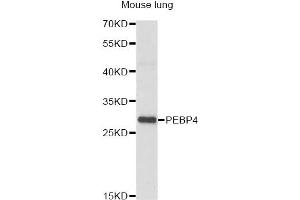 Western blot analysis of extracts of mouse lung, using PEBP4 antibody (ABIN6293825) at 1:1000 dilution. (PEBP4 抗体)