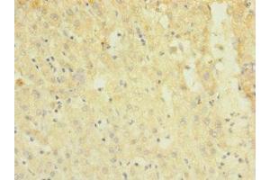 Immunohistochemistry (IHC) image for anti-Transient Receptor Potential Cation Channel, Subfamily M, Member 7 (TRPM7) (AA 756-855) antibody (ABIN7172869)