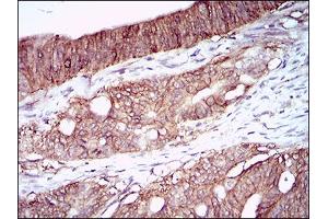 Immunohistochemistry (IHC) image for anti-Carbonic Anhydrase IX (CA9) (AA 37-186) antibody (ABIN1724883)