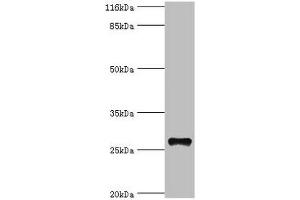 Western blot All lanes: TSPAN6 antibody at 20 μg/mL + Mouse liver tissue Secondary Goat polyclonal to rabbit IgG at 1/10000 dilution Predicted band size: 28 kDa Observed band size: 28 kDa (Tetraspanin 6 抗体  (AA 115-208))