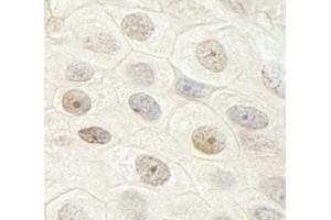 Immunohistochemistry (IHC) image for anti-DEAH (Asp-Glu-Ala-His) Box Polypeptide 33 (DHX33) (AA 1-50) antibody (ABIN7448528) (DHX33 抗体  (AA 1-50))
