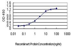 Detection limit for recombinant GST tagged RP6-213H19. (STK26/MST4 抗体  (AA 331-415))