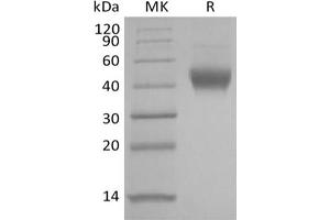 Western Blotting (WB) image for Interleukin 7 Receptor (IL7R) protein (His tag) (ABIN7319848)