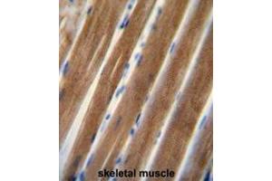 TNIP1 antibody (C-term) immunohistochemistry analysis in formalin fixed and paraffin embedded human skeletal muscle followed by peroxidase conjugation of the secondary antibody and DAB staining. (TNIP1 抗体  (C-Term))
