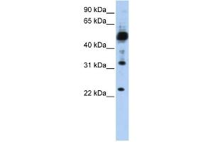 WB Suggested Anti-TMEM38B Antibody Titration:  0. (TMEM38B 抗体  (C-Term))