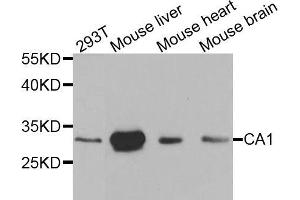 Western blot analysis of extracts of various cell lines, using CA1 antibody (ABIN5970404) at 1/1000 dilution. (CA1 抗体)