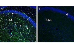 Expression of Secretin Receptor in rat hippocampusImmunohistochemical staining of perfusion-fixed frozen rat brain sections with Anti-Secretin Receptor (extracellular) Antibody (ABIN7043607, ABIN7044414 and ABIN7044415), (1:200), followed by goat anti-rabbit-AlexaFluor-488. (Secretin Receptor (SCTR) Peptide)