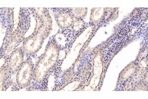 Detection of CHEM in Human Kidney Tissue using Monoclonal Antibody to Chemerin (CHEM) (Chemerin 抗体  (AA 33-158))
