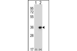 Western blot analysis of DLX4 (arrow) using rabbit polyclonal DLX4 Antibody (Center) (ABIN657967 and ABIN2846913). (DLX4 抗体  (AA 72-100))