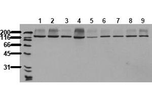 Western Blotting (WB) image for anti-RAPTOR (RAPTOR) antibody (ABIN492625) (RAPTOR 抗体)