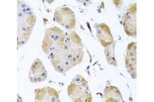 Immunohistochemistry of paraffin-embedded Human stomach using MYLK Polyclonal Antibody at dilution of 1:100 (40x lens). (MYLK 抗体)