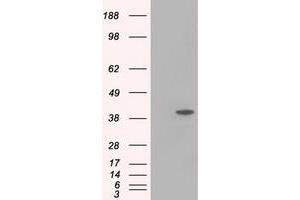 Image no. 3 for anti-Acetyl-CoA Acetyltransferase 2 (ACAT2) antibody (ABIN1496404)