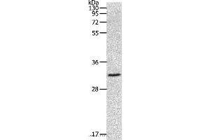Western blot analysis of 293T cell, using MMP26 Polyclonal Antibody at dilution of 1:500 (MMP26 抗体)