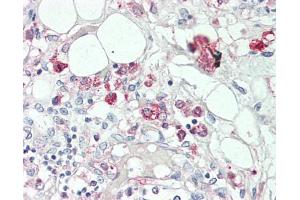 Human Thymus: Formalin-Fixed, Paraffin-Embedded (FFPE), at a concentration of 5 ug/ml. (CCR6 抗体  (AA 18-46))