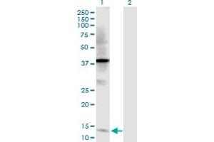 Western Blot analysis of TFF2 expression in transfected 293T cell line by TFF2 MaxPab polyclonal antibody. (Trefoil Factor 2 抗体  (AA 1-129))