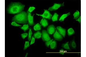 Immunofluorescence of monoclonal antibody to TRIM25 on HeLa cell. (TRIM25 抗体  (AA 211-310))