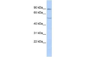 Western Blotting (WB) image for anti-Cadherin 4 (CDH4) antibody (ABIN2458919) (Cadherin 4 抗体)