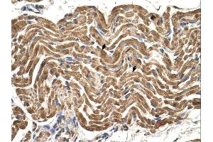 Immunohistochemistry (IHC) image for anti-ATP Synthase, H+ Transporting, Mitochondrial F1 Complex, beta Polypeptide (ATP5B) (C-Term) antibody (ABIN629673)