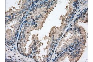 Image no. 1 for anti-Proto-Oncogene Pim-2 (Serine Threonine Kinase) (PIM2) antibody (ABIN1500220) (PIM2 抗体)