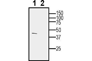 Western blot analysis of human  breast adenocarcinoma cell line lysate:1.