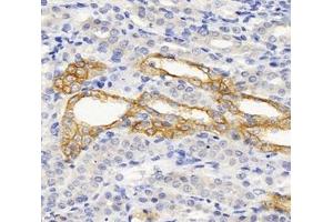 Immunohistochemistry (Paraffin-embedded Sections) (IHC (p)) image for anti-Spectrin, Beta, Non-erythrocytic 2 (SPTBN2) antibody (ABIN7075698)