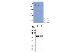 The cell lysate of HeLa (40ug) were resolved by SDS-PAGE, transferred to PVDF membrane and probed with anti-human PARP2 antibody (1:500 ~ 1:5000).