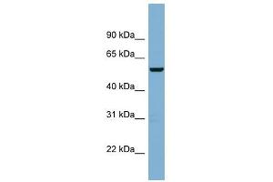 C2ORF29 antibody used at 1 ug/ml to detect target protein. (CNOT11 抗体  (Middle Region))