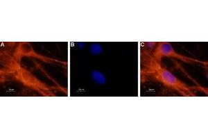 Immunocytochemistry (ICC) image for anti-Sodium Channel, Voltage-Gated, Type VIII, alpha (SCN8A) (AA 1042-1061) antibody (ABIN7043651)