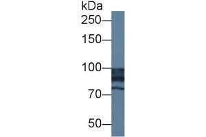 Western Blotting (WB) image for anti-N-Acetylglucosaminidase, alpha (NAGLU) (AA 485-743) antibody (ABIN7435373)
