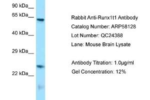 Western Blotting (WB) image for anti-Runt-Related Transcription Factor 1, Translocated To, 1 (Cyclin D-Related) (RUNX1T1) (N-Term) antibody (ABIN2787563)