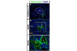 Immunohistochemical assessment of proteins involved in blood coagulation in ob/ob pancreata. (Fibronectin 1 抗体)