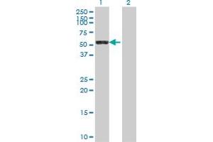 Western Blot analysis of LAP3 expression in transfected 293T cell line by LAP3 polyclonal antibody (A01). (LAP3 抗体  (AA 420-519))