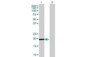 Lane 1: DUSP26 transfected lysate ( 23. (DUSP26 293T Cell Transient Overexpression Lysate(Denatured))