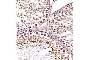 Immunohistochemistry of paraffin embedded rat testis using SRP14 (ABIN7075596) at dilution of 1:300 (400x lens) (SRP14 抗体)