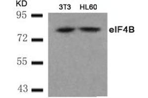 Image no. 2 for anti-Eukaryotic Translation Initiation Factor 4B (EIF4B) (AA 420-424) antibody (ABIN401568) (EIF4B 抗体  (AA 420-424))