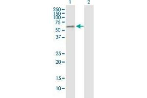 Western Blotting (WB) image for anti-GA Binding Protein Transcription Factor, alpha Subunit 60kDa (GABPA) (AA 1-100) antibody (ABIN515888)