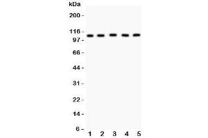 Western blot testing of MSH2 antibody and Lane 1:  mouse testis;  2: (m) skeletal muscle;  3: human HeLa;  4: (h) A549;  5: (h) SMMC-7721 lysate. (MSH2 抗体  (AA 337-583))