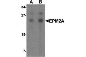 Western blot analysis of SW480 in SW480 cell lysate with EPM2A Antibody  at (A) 1 and (B) 2 μg/ml. (EPM2A 抗体  (C-Term))