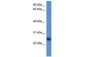 WB Suggested Anti-SLA2 Antibody Titration: 0. (SLAP2 抗体  (Middle Region))