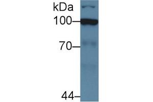 Western Blot; Sample: Human Jurkat cell lysate; Primary Ab: 5µg/ml Rabbit Anti-Human HK2 Antibody Second Ab: 0. (Hexokinase 2 抗体  (AA 469-669))