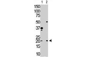 The HPCA polyclonal antibody  is used in Western blot to detect HPCA in Y79 cell lysate (Lane 1) and mouse brain tissue lysate (Lane 2) . (Hippocalcin 抗体  (N-Term))
