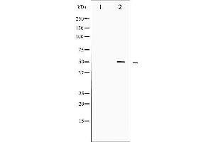Western blot analysis of SRF phosphorylation expression in Serum treated LOVO whole cell lysates,The lane on the left is treated with the antigen-specific peptide. (SRF 抗体  (pSer99))