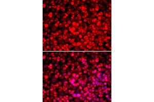Immunofluorescence analysis of HeLa cells using PUF60 antibody. (PUF60 抗体)