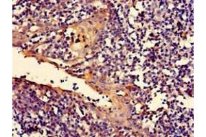 Immunohistochemistry (IHC) image for anti-RalA Binding Protein 1 (RALBP1) (AA 6-105) antibody (ABIN7167078)